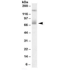 Mesothelin Antibody