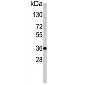 NANOS1 Antibody