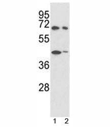 Western blot analysis of SHP2 antibody and 1) 293, 2) K562 lysate. Predicted molecular weight: ~68kD