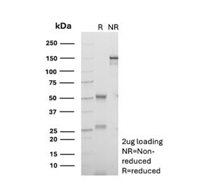 SDS-PAGE Analysis of Purified, BSA-Free CD18 Antibody (clone 68-5A5). Confirmation of Integrity and