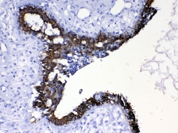 Cytokeratin 8 Antibody