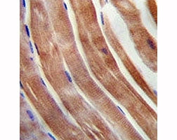 KEAP1 antibody immunohistochemistry analysis in formalin fixed and paraffin embedded human skeletal