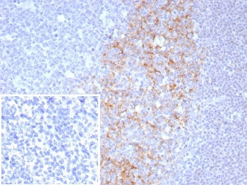 IHC staining of FFPE human tonsil tissue with CD23 antibody (clone FCER2/8511R). Inset: PBS used in
