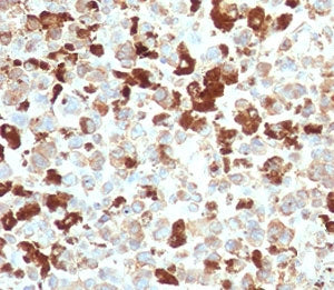 NGF Receptor Antibody / p75NTR / CD271