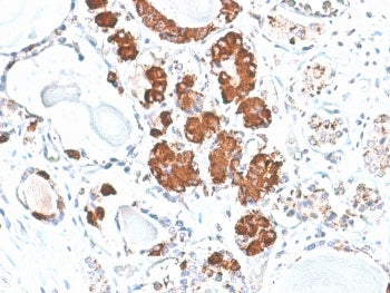IHC staining of FFPE human pituitary with recombinant ACTH antibody (clone rCLIP/1407). HIER: boil t