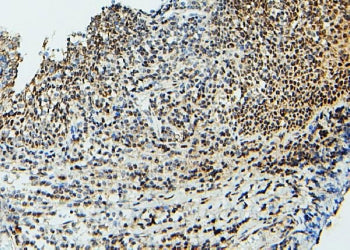UBC9 Antibody / UBE2I