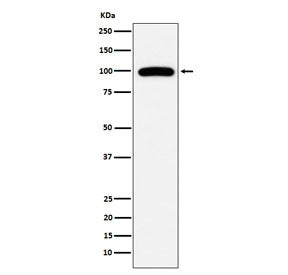 CD10 Antibody / Neprilysin
