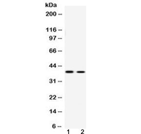 Western blot testing of human 1) U-2 OS and 2) SW620 cell lysate with ATF4 antibody at 0.5ug/ml. Pre