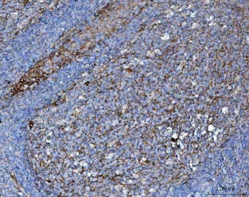 IHC staining of FFPE human tonsil tissue with B7-H3 antibody. HIER: boil tissue sections in pH8 EDTA