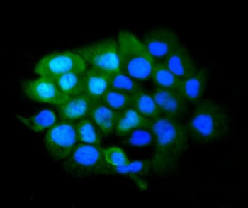 SLBP Antibody