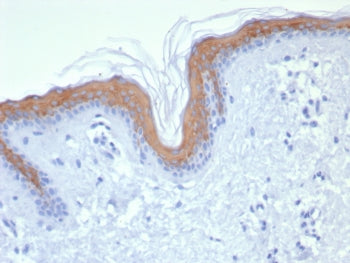 Cytokeratin 1 Antibody