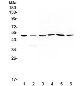 HGD Antibody / Homogentisate 1,2-dioxygenase