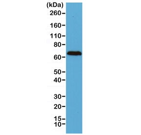 Neurofilament Antibody (-Light) / NF-L / NEFL