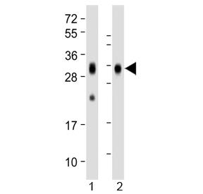 Folate Receptor beta Antibody (FOLR2)