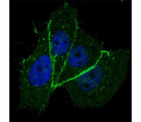 HER2 Antibody (ERBB2) (phospho-T1172)