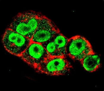 TIMP1 Antibody