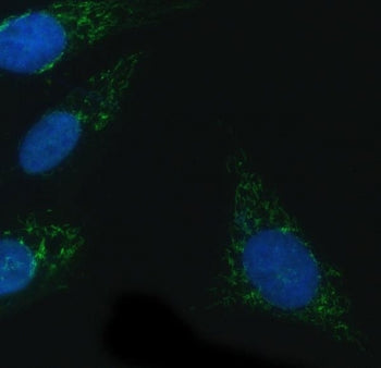 NOX4 Antibody / NADPH oxidase 4