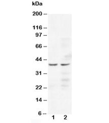 CCR5 Antibody