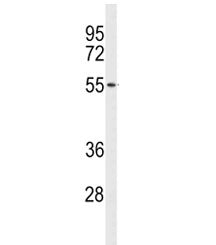 ACCN1 Antibody / ASIC2