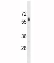 SPHK2 Antibody