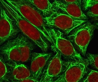 Immunofluorescent staining of permeabilized human MCF7 cells with Cytokeratin 18 antibody (clone CTK