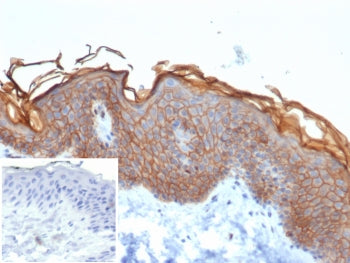 S100A16 Antibody