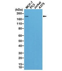 HER2 Antibody / ErbB2