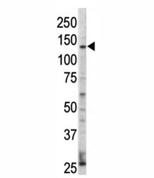 ERBB4 Antibody (HER4)
