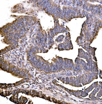 HIP1R Antibody / Huntingtin-interacting protein 1-related protein
