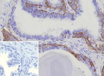 KRT15 Antibody / Cytokeratin 15