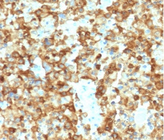 PMEL17 / Melanoma gp100 Antibody