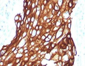 Acidic Cytokeratin Antibody