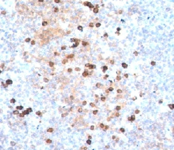IHC testing of human tonsil stained with IgM heavy chain antibody.