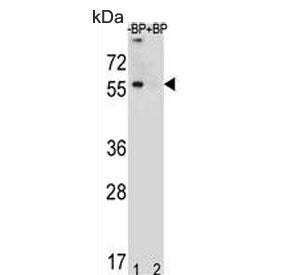 TOX3 Antibody