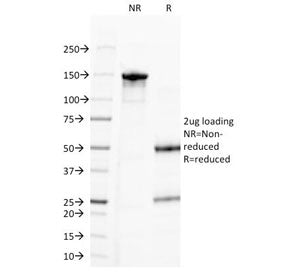 Progesterone Antibody