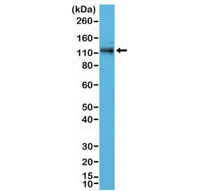 Recombinant p120-Catenin Antibody / CTNND1 / Catenin delta 1