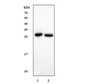 Carbonic Anhydrase I Antibody