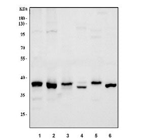 Western blot testing of 1) human HeLa, 2) human K562, 3) human Jurkat, 4) rat liver, 5) rat C6 and 6