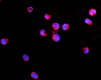 Immunofluorescent staining of FFPE human K562 cells with IL2RG antibody (red) and DAPI nuclear stain