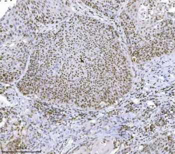 KDM4A Antibody / JMJD2A / JHDM3A