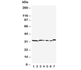 Caspase-6 Antibody