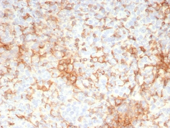 Adipophilin Antibody / Perilipin 2 / ADRP / PLIN2