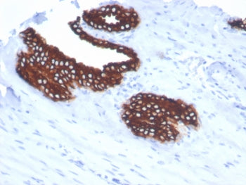 Cytokeratin 18 Antibody