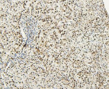 NR1I2 Antibody / PXR