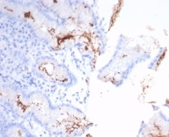 IHC staining of H. pylori-infected FFPE human stomach tissue with Helicobacter pylori antibody (clon
