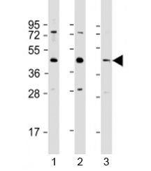 Western blot testing of 1) human HeLa, 2) human A549 and 3) mouse brain lysate with G6PC3 antibody a