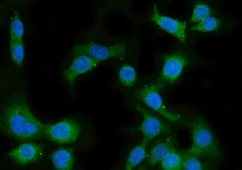 Lanosterol 14-alpha demethylase Antibody / CYP51A1