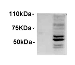 Western blot testing of IFNb-treated WI-38 lysate with AIM2 antibody at 1ug/ml. Predicted molecular