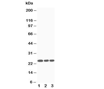 Western blot testing of SOCS3 antibody and Lane 1: Jurkat; 2: CEM; 3: Raji cell lysate. Predicted mo