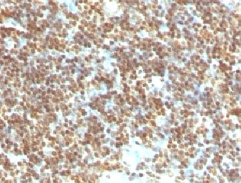 dsDNA Antibody / Double Stranded DNA